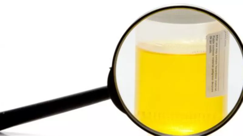 الفرق بين سكر الدم والبول.. متى نجب زيارة الطبيب؟