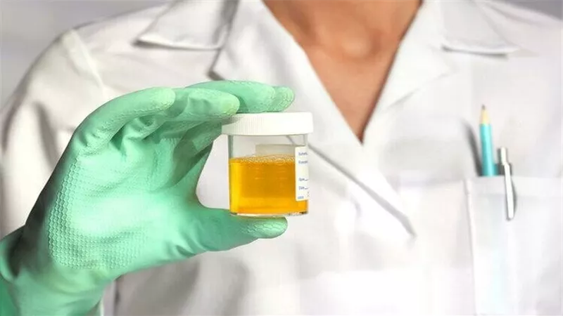 أسباب التهاب البول المتكرر.. 5 عوامل تزيد فرص الإصابة وإليكم الأعراض والعلاج