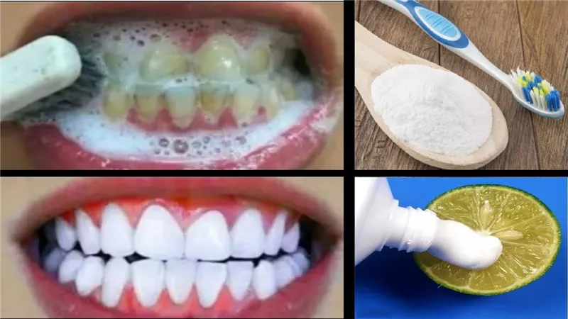 تبييض الأسنان في المنزل.. 5 وصفات طبيعية تضمن لكِ أسنان مشرقة