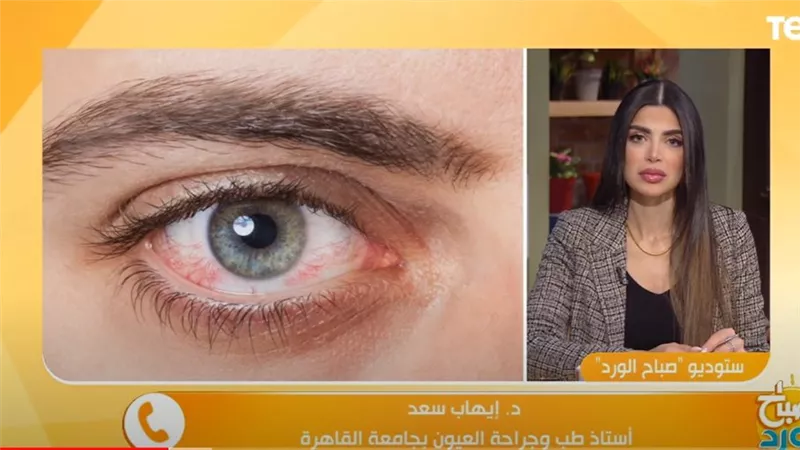 نصائح مهمة لحماية العين من جفاف الشتاء (فيديو)