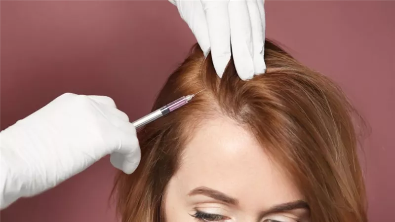 علاج الصلع للنساء بـ 4 تقنيات تجميلية أبرزها البلازما والميزوثيرابي