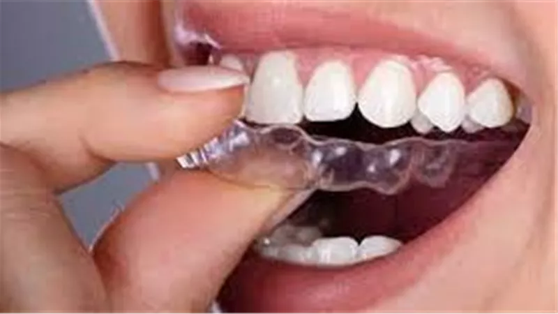 أعراض ألم الأسنان بعد أكل الحلويات.. الحارس الليلي أحد الحلول