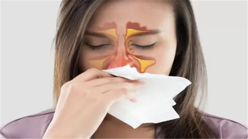 علاج حساسية الأنف نهائيا بخطوات دوائية وأخرى منزلية