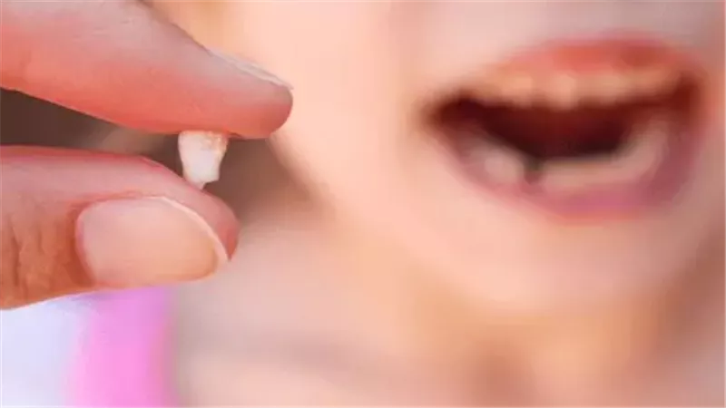 تفسير حلم خلع السن للعزباء ابن سيرين.. دلالات مبشرة للرائية