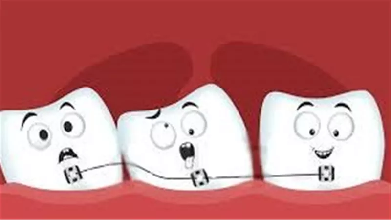 أسباب الإصابة بـ الأسنان المزدحمة.. 3 عوامل رئيسية 