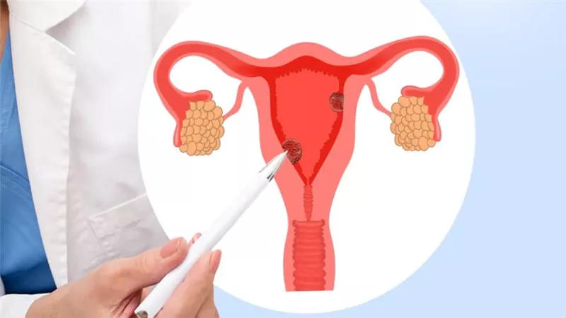 7 معلومات عن بطانة الرحم الطبيعية.. اعرفي سُمكها المناسب للحمل