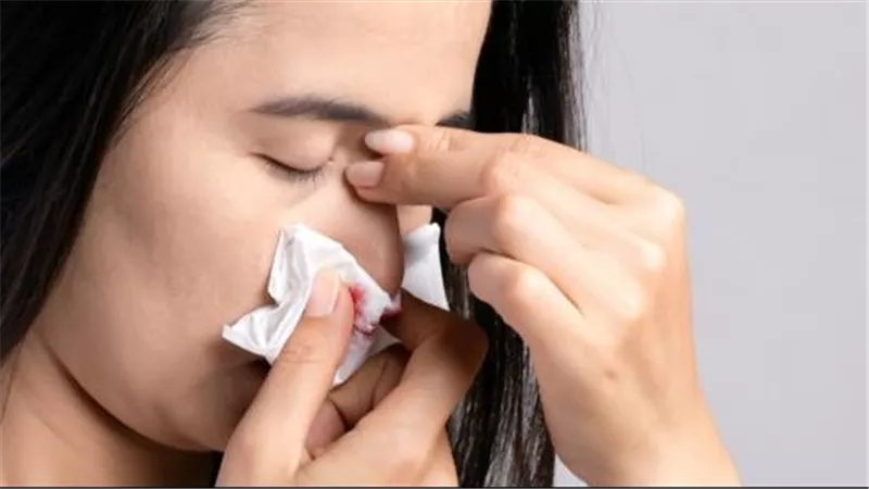 متى يكون نزيف الأنف خطير؟.. انتبه لـ 6 علامات رئيسية