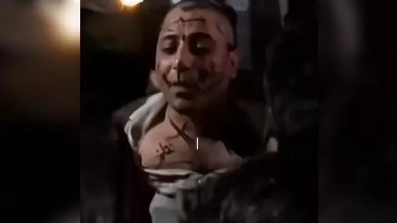 تفاصيل الاعتداء على الفنان السوري عمر خيري تثير جدلًا واسعًا في ريف حلب