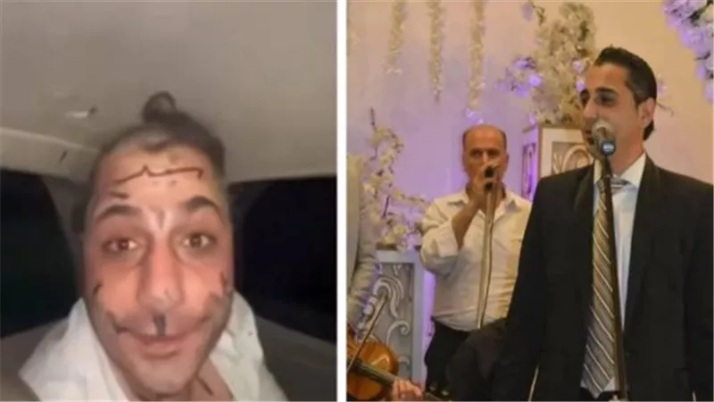 من هو عمر خيري؟ ولماذا تعرّض للضرب والإهانة أثناء حفل زفاف؟