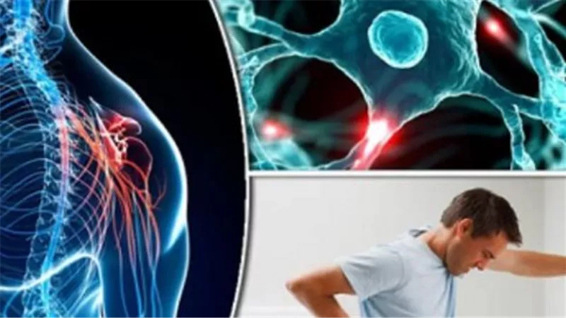 التصلب المتعدد (MS): دليل شامل حول 