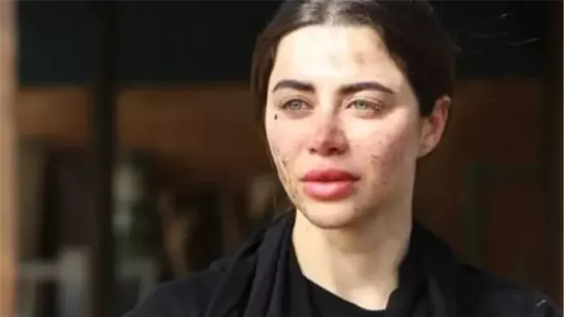 كل ما تريد معرفته عن يارا السكري بطلة مسلسل علي كلاي في رمضان 2026