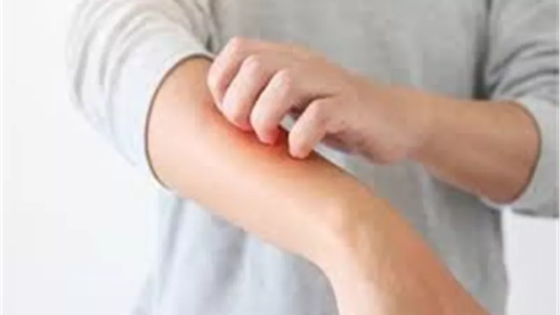 تعرف على أعراض على الجلد للإصابة بأوميكرون