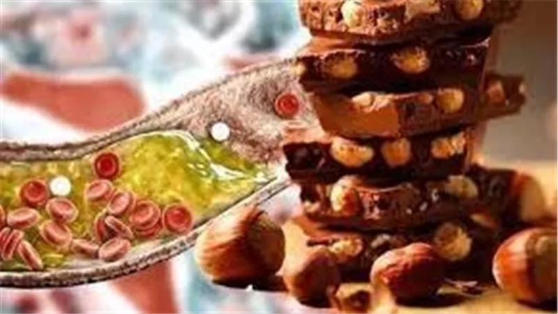 باحثون يؤكدون أن الشوكولاتة فعالة في خفض نسبة كوليسترول الدم