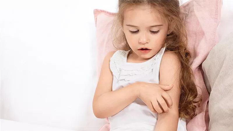 لتخفيف حدة المتاعب.. عليك العناية السليمة ببشرة الطفل المصاب بالإكزيما