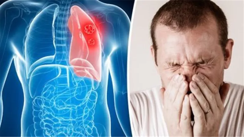 دواء يُعتبر أكبر اختراق علاجي منذ عقود لسرطان الرئة