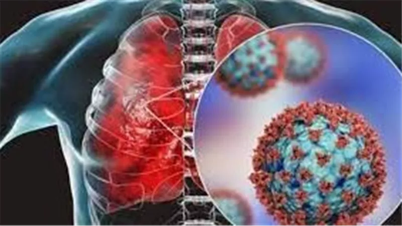 هكذا يمكنك أن تقلل من خطر تلف الرئة من 