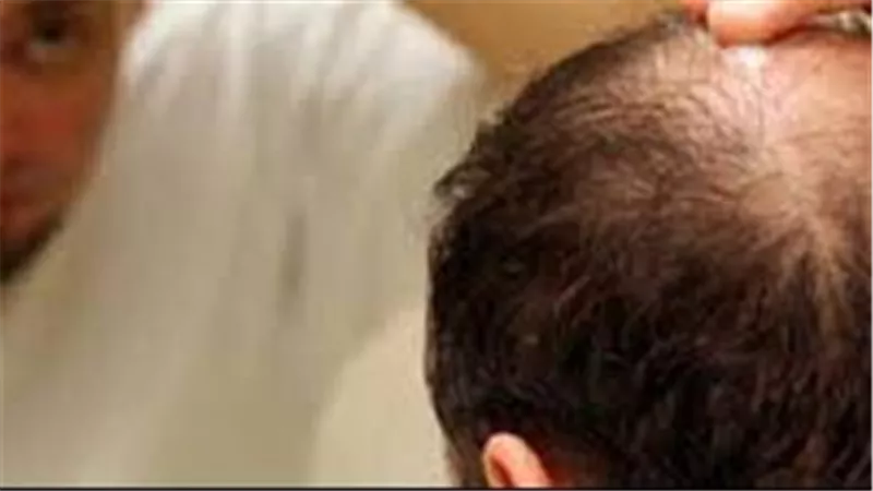 باحثون ينجحون في تحديد الإشارات الجزيئية التي تحفز تكوين بصيلات الشعر وتجديدها