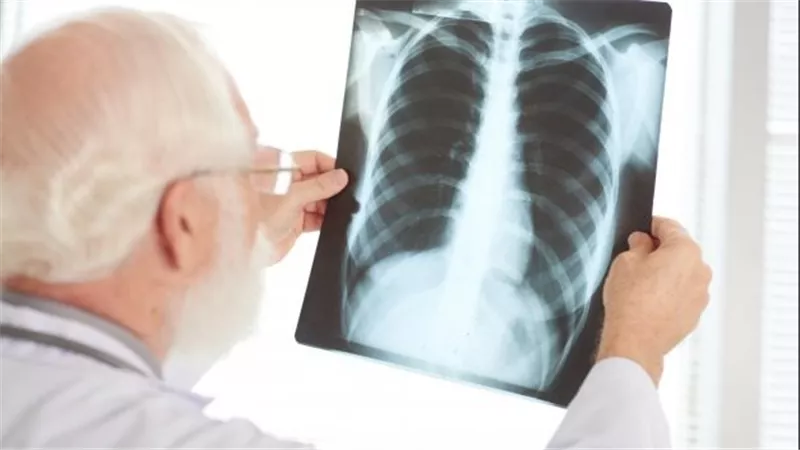 الأشعة يمكن أن يكون مفيدا في حالات معينة.. ما هي؟