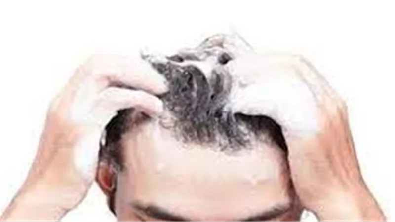 أطباء: للشامبو المضاد لقشرة الرأس آثارا جانبية سلبية على فروة الرأس
