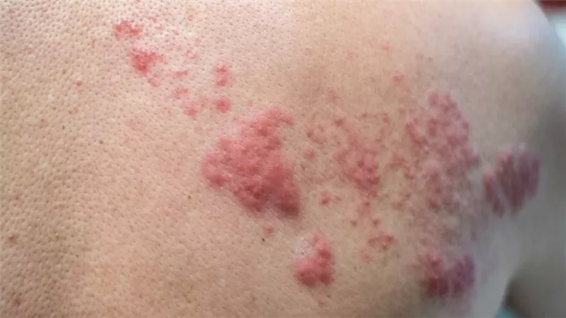 أسباب وأعراض 