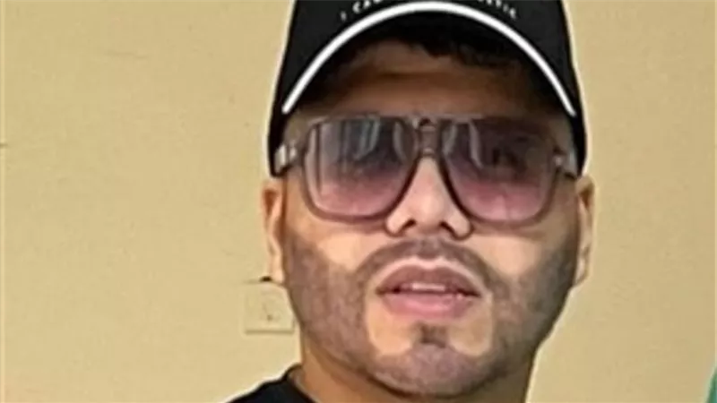 عمر كمال يكشف سبب إقدامه على إجراء عملية تجميلية لزراعة اللحية