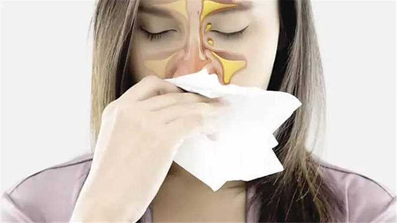 ما هي الجيوب الأنفية؟.. عبارة عن أربعة تجاويف في الرأس