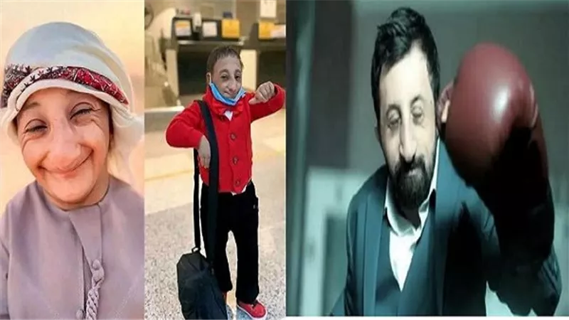 مصاب به كوكسال بابا وتوفى بسببه عزيز الأحمد.. ما هو مرض GHD؟
